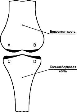 ГОСТ Р ИСО 7207-1-2005 Имплантаты для хирургии. Бедренный и большеберцовый компоненты частичных и тотальных эндопротезов коленного сустава. Часть 1. Классификация, определения и обозначение размеров
