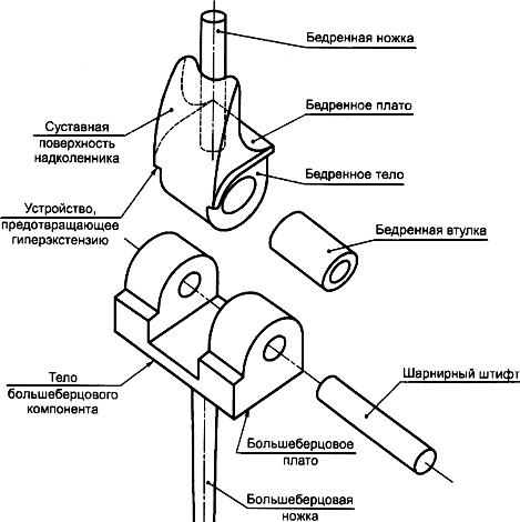 ГОСТ Р ИСО 7207-1-2005 Имплантаты для хирургии. Бедренный и большеберцовый компоненты частичных и тотальных эндопротезов коленного сустава. Часть 1. Классификация, определения и обозначение размеров